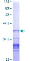 Human CTNND1 / p120 Catenin Protein (Recombinant GST, N-terminus)