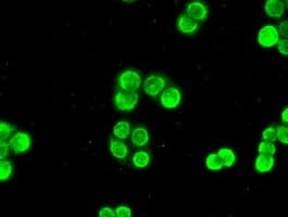 CHEK2 / CHK2 Antibody (clone OTI5C4)