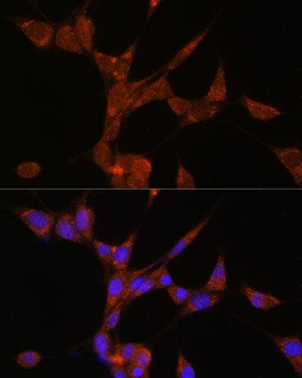 DDX / AKR1C3 Antibody
