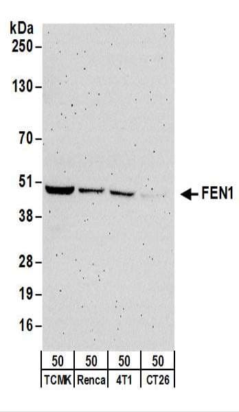 Polyclonal Rabbit anti-Human FEN1 Antibody (aa75-125, WB)