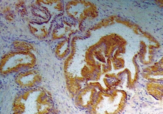 Monoclonal Mouse anti-Human PSA-ACT Complex Antibody (clone A67-B/E3, IHC, WB)