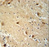 TBC1D14 Antibody (aa259-286)