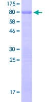Human SP7 / Osterix Protein (Recombinant GST)