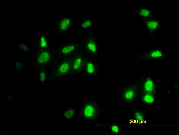 IHC-plus™ RAD18 Antibody (clone 3H7)