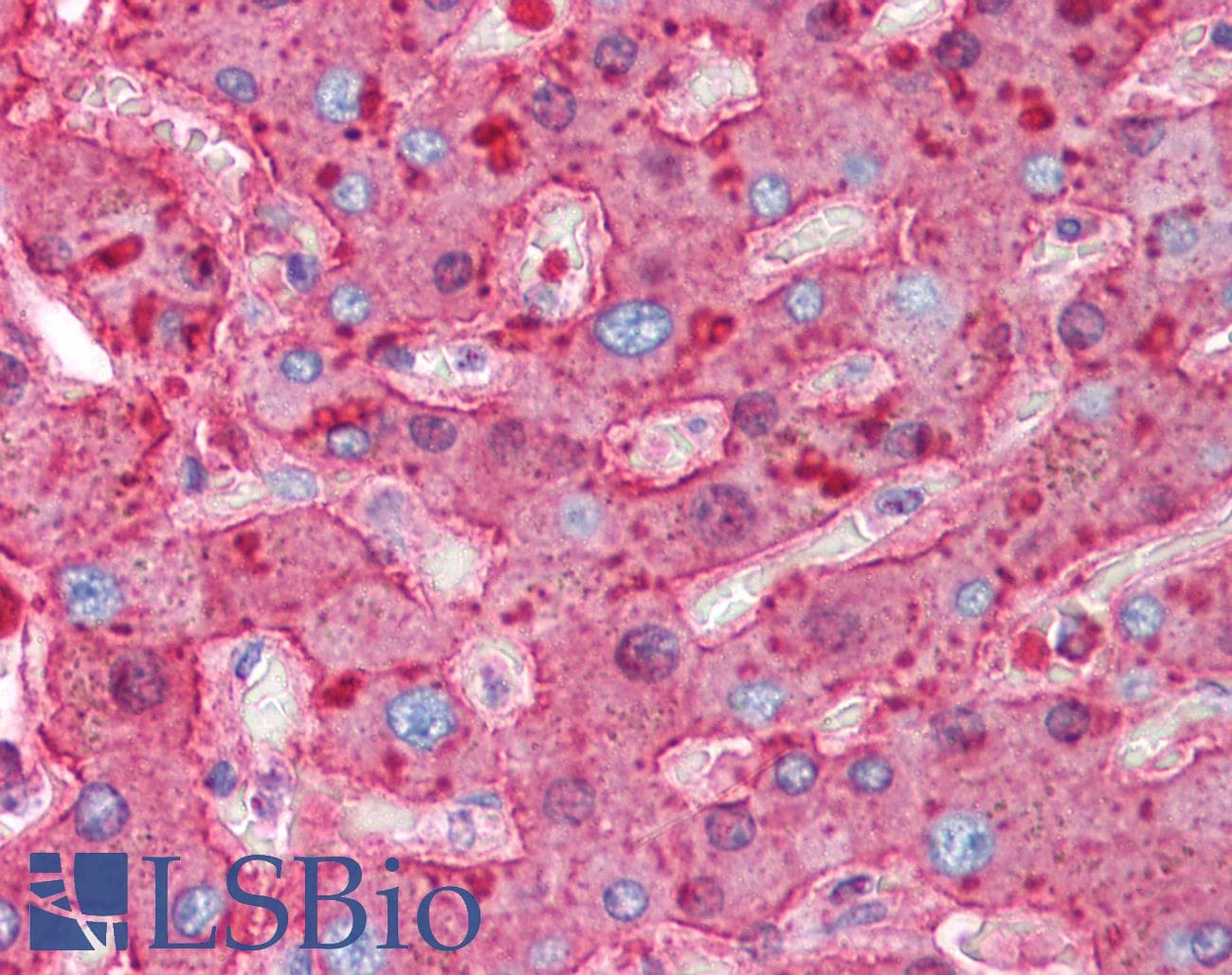 PathPlus™ Polyclonal Rabbit anti-Human HP / Haptoglobin Antibody (IHC, WB)