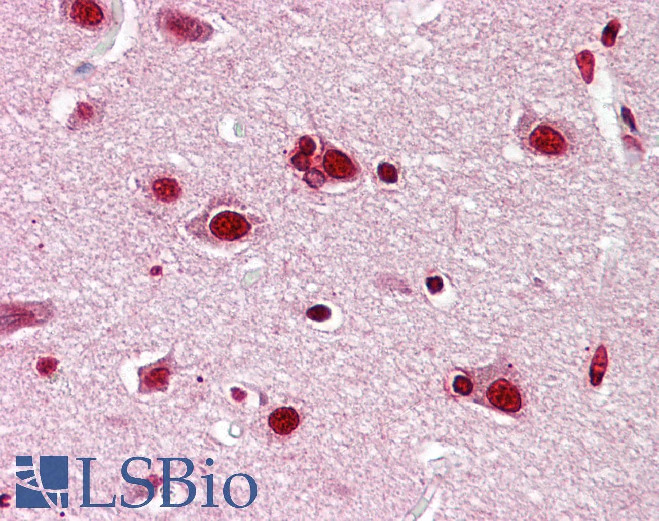 PathPlus™ Polyclonal Rabbit anti-Human JUN / c-Jun Antibody (aa210-259, IHC, WB)