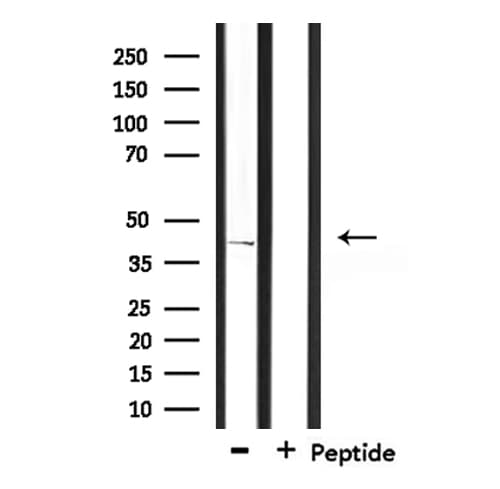CD2BP2 Antibody