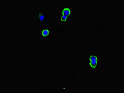 Polyclonal Rabbit anti-Human CD79B / CD79 Beta Antibody (IF)