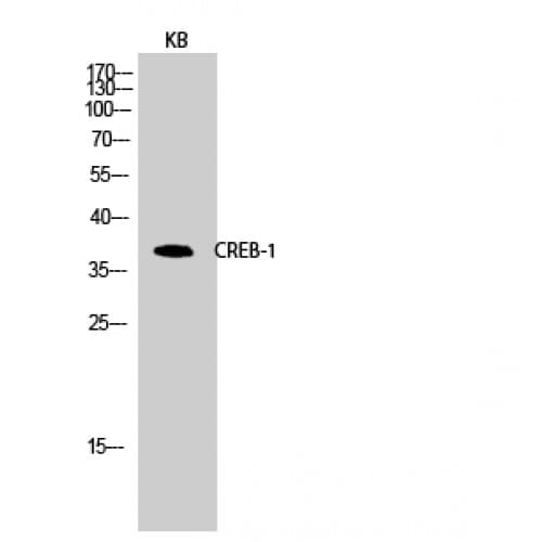 CREB1 / CREB Antibody (70-150 aa)