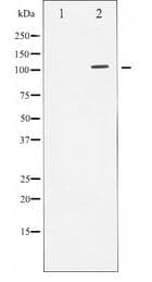 AR / Androgen Receptor Antibody