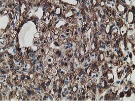 ERGIC-53 / LMAN1 Antibody (clone OTI1E3)
