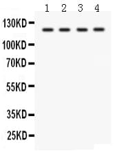 Polyclonal Rabbit anti-Human SLC12A1 / NKCC2 Antibody (aa52-83, IHC, WB)