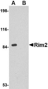 RIMS2 / RIM2 Antibody