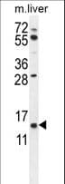 Polyclonal Rabbit anti-Human GTSF1 Antibody (aa37-66, IHC, WB)