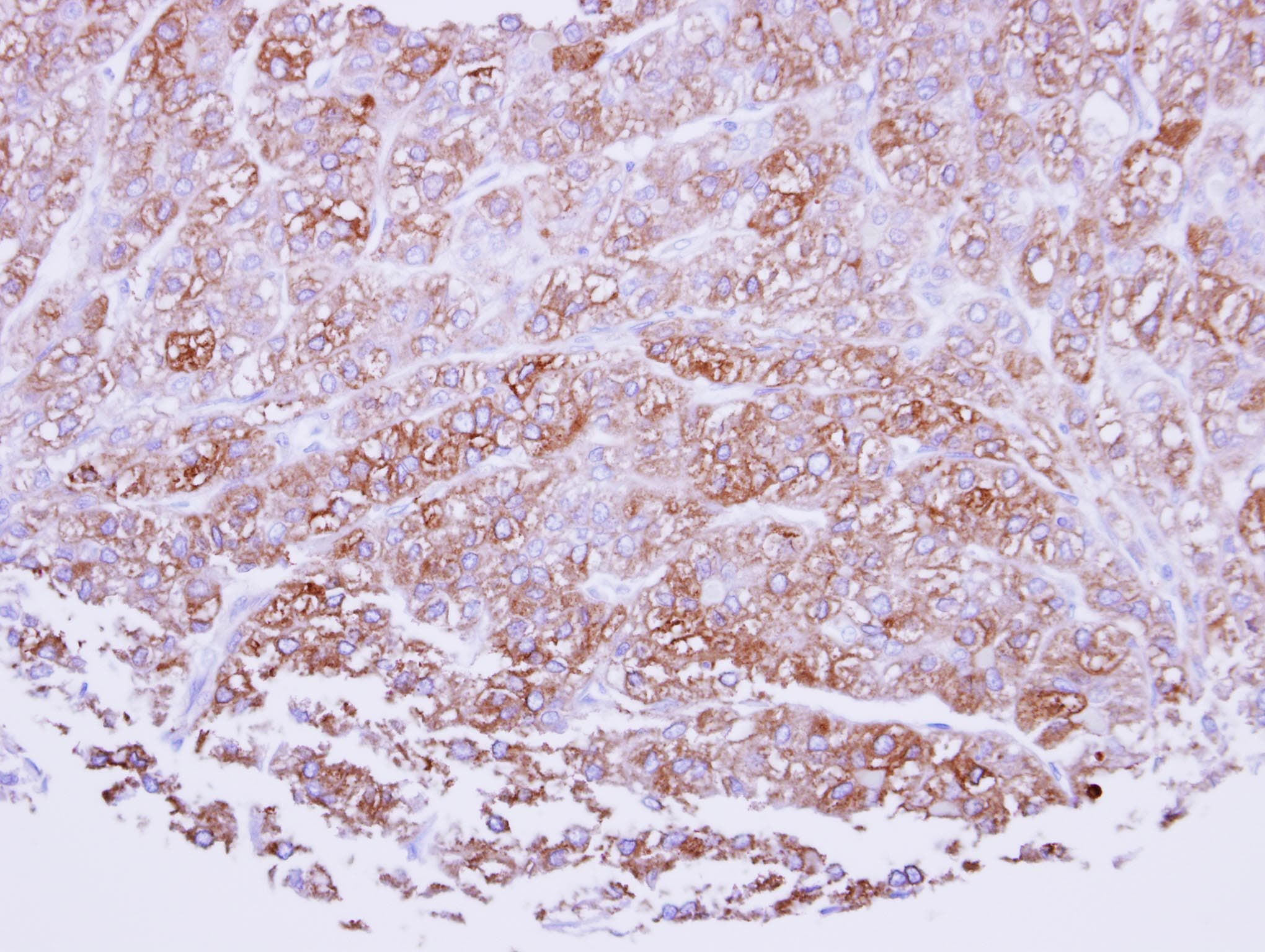 ICAM2 / CD102 Antibody (aa1-189)