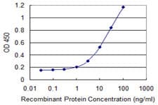 IHC-plus™ FBN1 / Fibrillin 1 Antibody (clone 3H6)