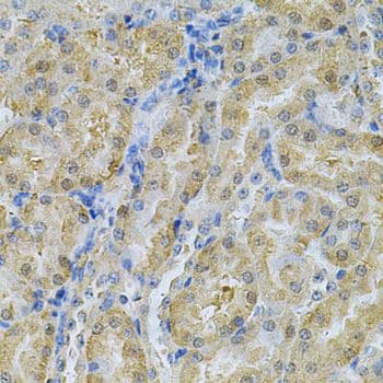 SERPINA6 / CBG Antibody
