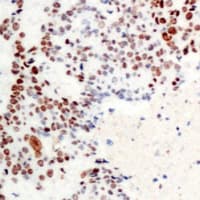 ATF2 Antibody (N-Terminus)