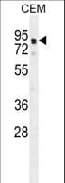 GLB1L2 Antibody (aa479-507)