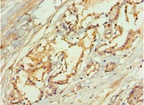 Polyclonal Rabbit anti-Human LAMTOR3 / MP1 Antibody (aa1-124, IHC)