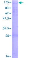 Human ZHX3 Protein (Recombinant GST)