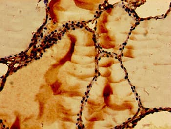 RAB5A / RAB5 Antibody