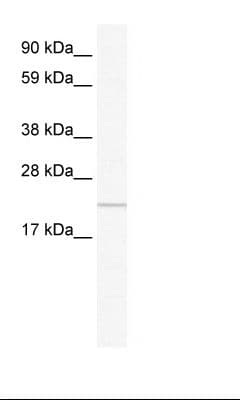 Polyclonal Rabbit anti-Human CFAP20 / GTL3 Antibody (C-Terminus, WB)
