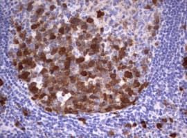 TS / Thymidylate Synthase Antibody (clone OTI1A6)