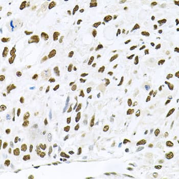 Polyclonal Rabbit anti-Human MAPK8 / JNK1 Antibody (IHC, IF, WB)