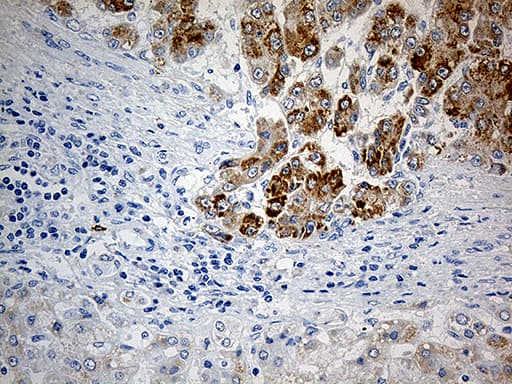 PYCR1 Antibody (aa1-319, clone OTI4F2, Carrier-free)