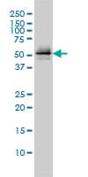 Monoclonal Mouse anti-Human PARK2 / Parkin 2 Antibody (clone 1H4, IF, WB)