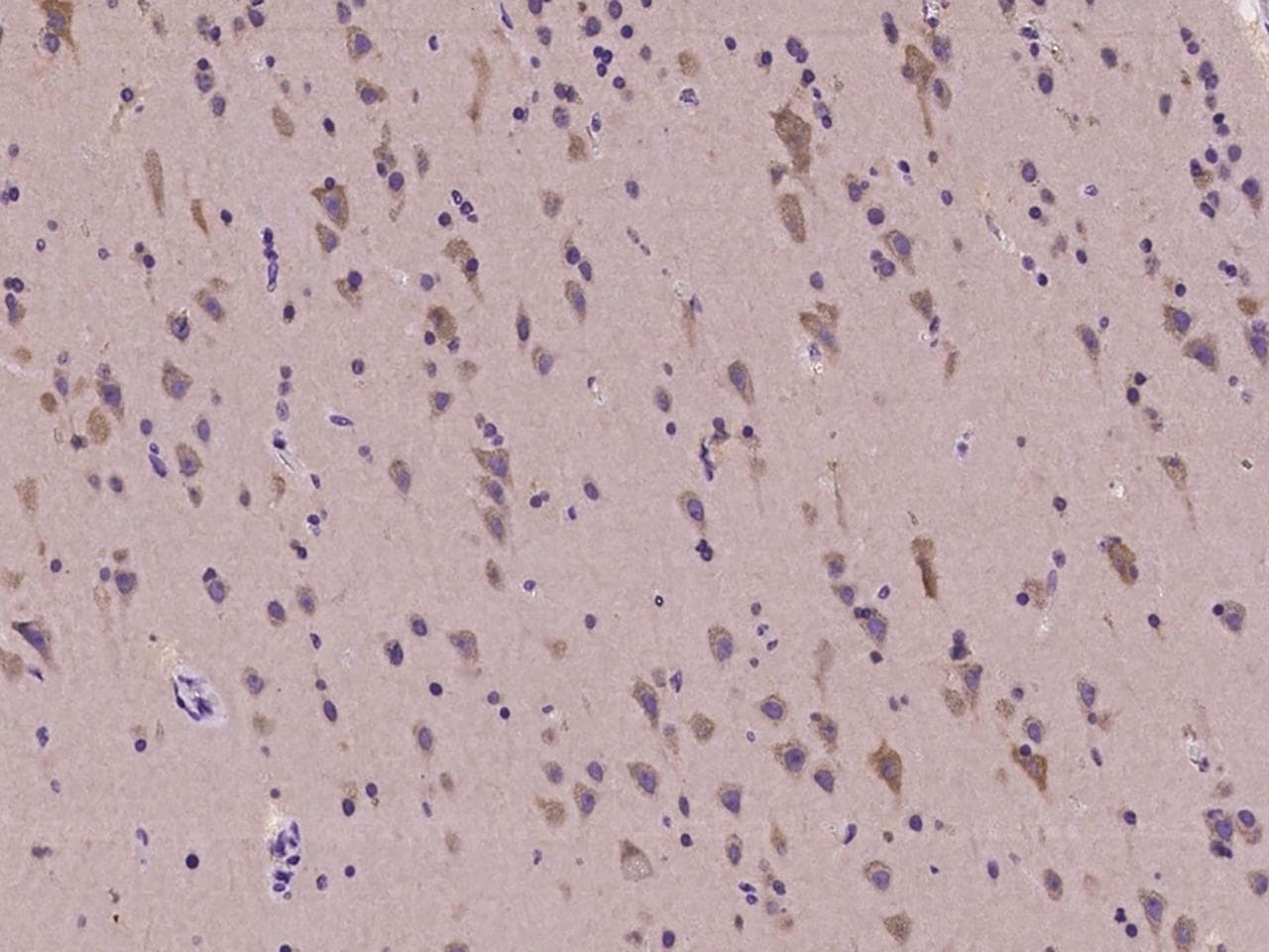 CELSR2 Antibody