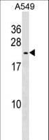 HSPB9 Antibody (aa70-96)