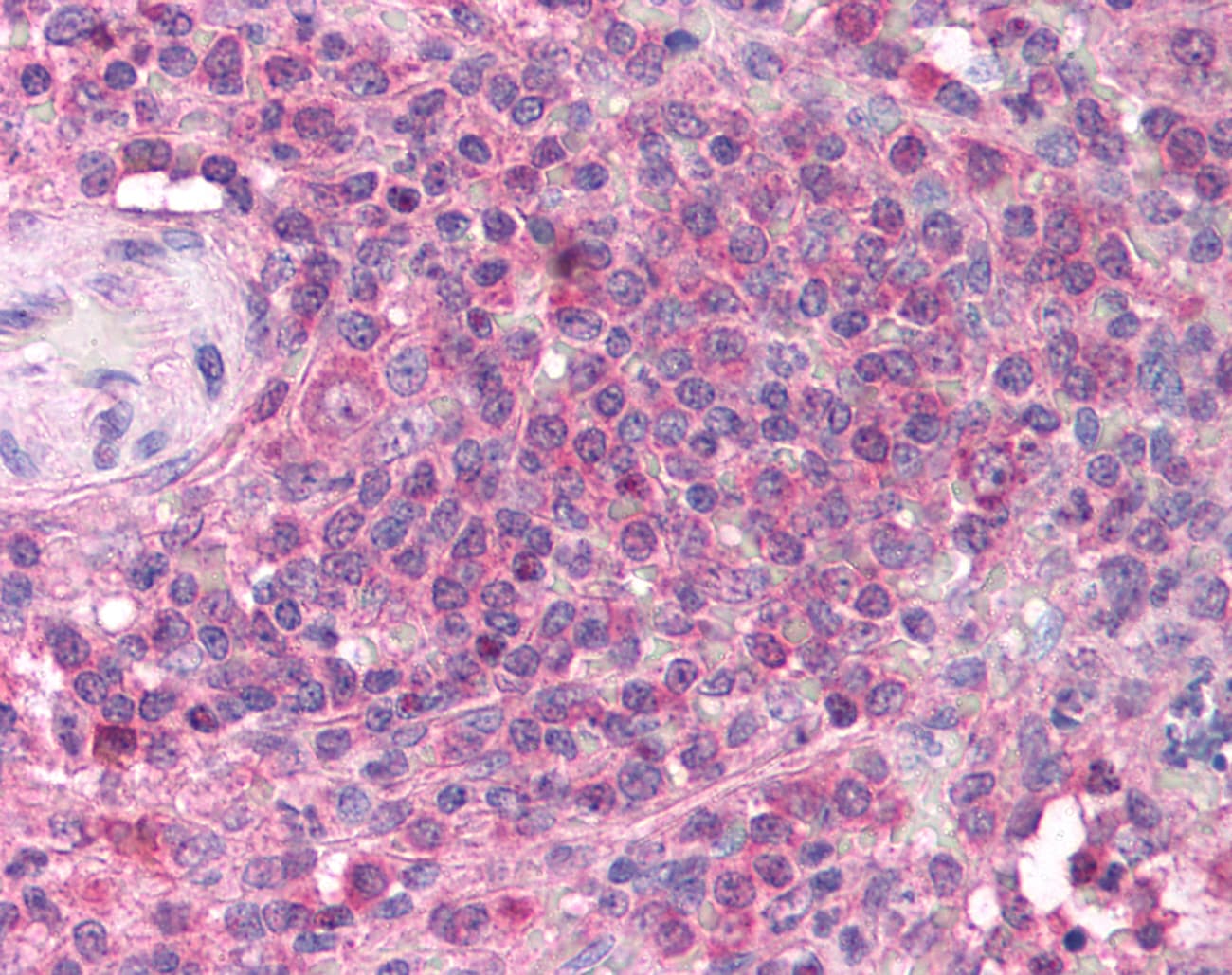 TRIM68 Antibody (aa279-328, HRP)