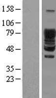 SCYL3 Protein (Over-Expression Lysate Myc-DDK (Flag))