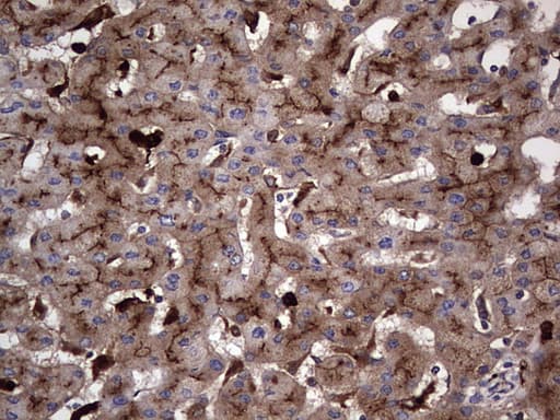 Monoclonal Mouse anti-Human CEACAM5 / CD66e Antibody (clone OTI3D8, aa35-680, IHC, WB)
