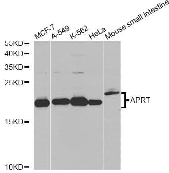Polyclonal Rabbit anti-Human APRT Antibody (aa1-180, IHC, WB)
