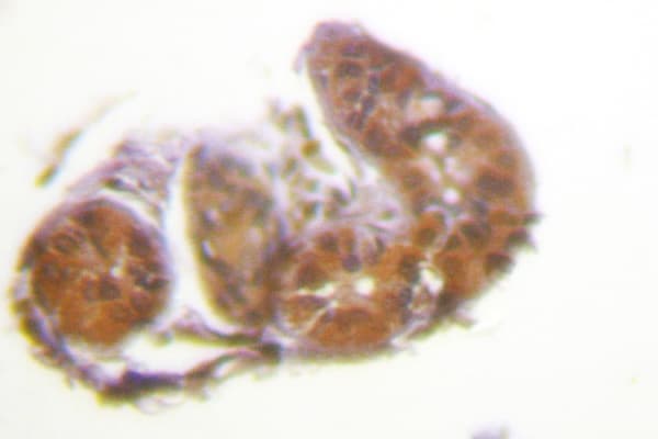 ETK / BMX Antibody (Lys35)