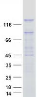 Human PAN2 / USP52 Protein (Recombinant Myc-DDK (Flag))