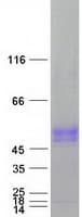Human SLC30A10 Protein (Recombinant Myc-DDK (Flag))