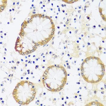 CAMK1 / CAMKI Antibody