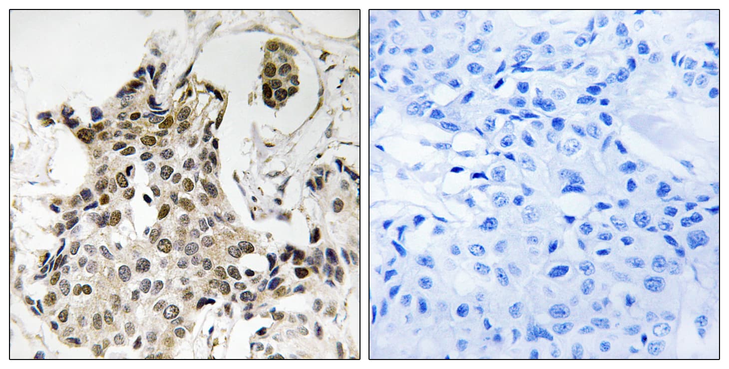 Polyclonal Rabbit anti-Human CBX3 / HP1 Gamma Antibody (aa59-108, IHC, WB)