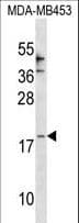 Polyclonal Rabbit anti-Human CCL25 / TECK Antibody (aa66-95, WB)