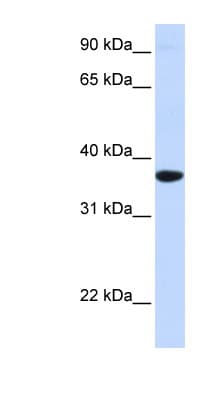 SCGN / Secretagogin Antibody (aa180-229)