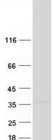 Human FAM78B Protein (Recombinant Myc-DDK (Flag))
