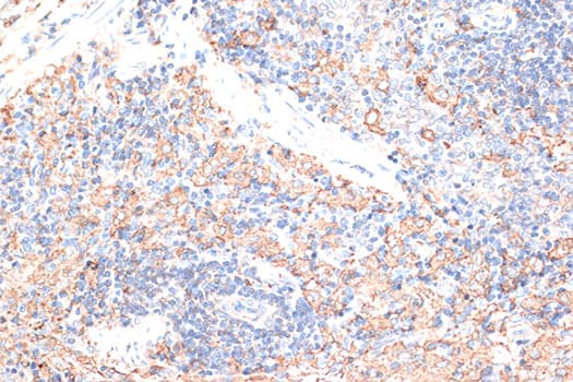 Polyclonal Rabbit anti-Human CD274 / B7-H1 / PD-L1 Antibody (IHC, IF, WB)