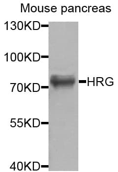 Polyclonal Rabbit anti-Human HRG Antibody (IHC, WB)