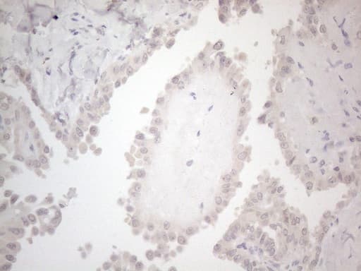 ANGPTL8 / Betatrophin Antibody (aa22-198, clone OTI1C6, Carrier-free)