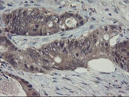 RPN1 / Ribophorin I Antibody (clone OTI5B1, Carrier-free)