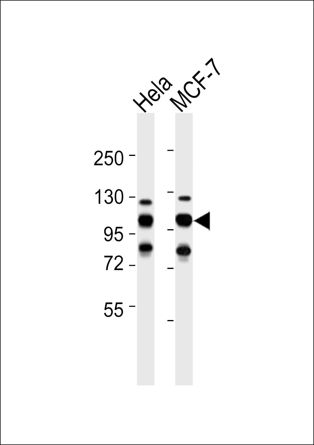HSP90B1 / GP96 / GRP94 Antibody